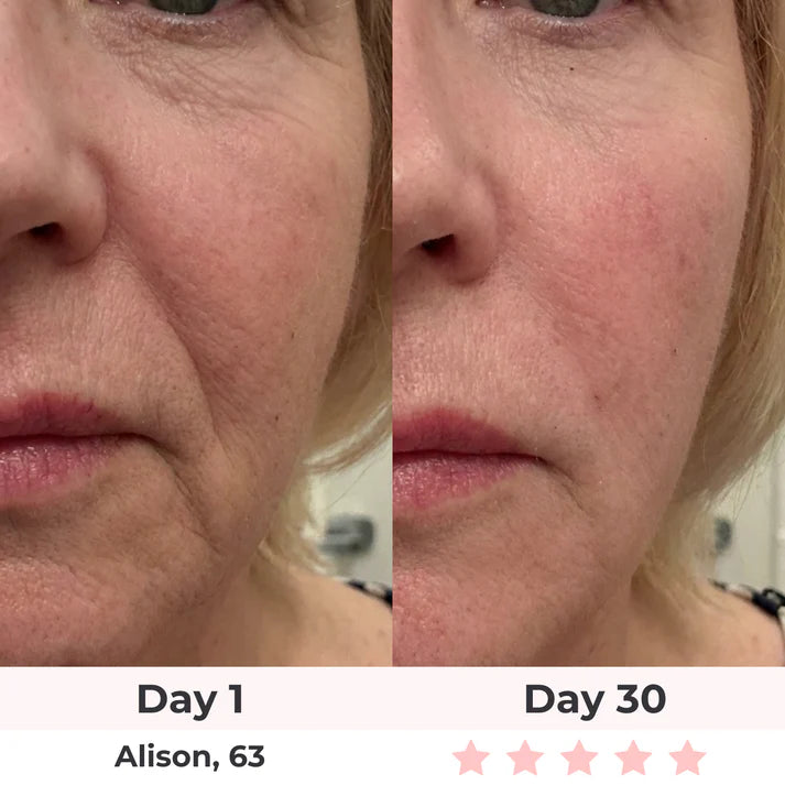 Nuvio™ SculptPro 7-in-1 Neck Revitalizer Nuvio Mall
